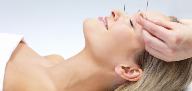 Acupuncture therapy - alternative medicine